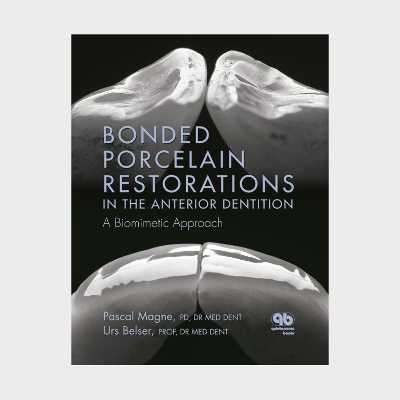 Bonded Porcelain Restorations in the Anterior Dentition