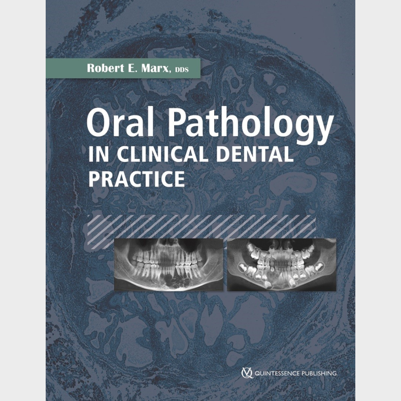 Oral Pathology in Clinical Dental Practice