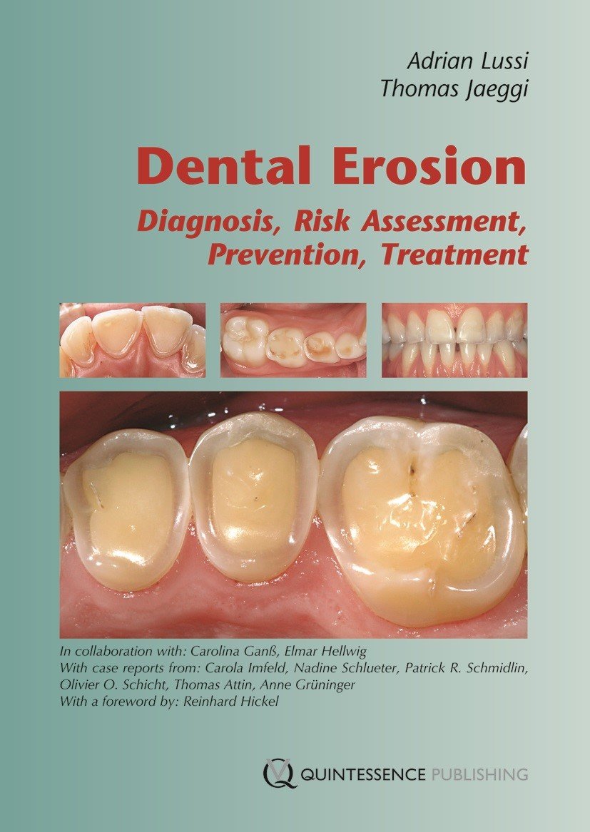 Dental Erosion - Bøger - Dentalinstituttet