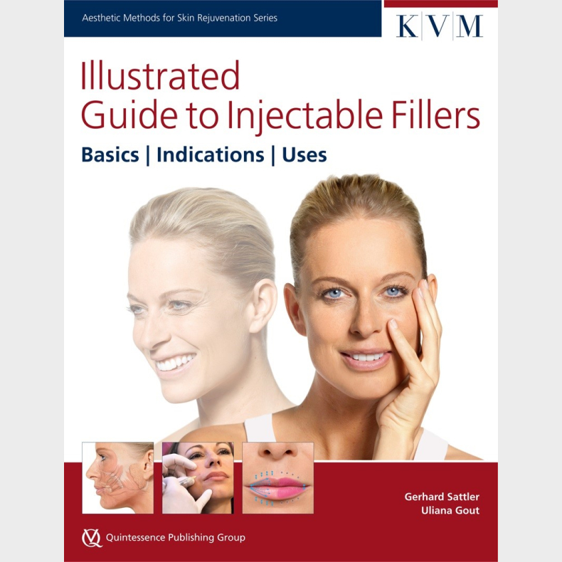 Illustrated Guide to Injectable Fillers