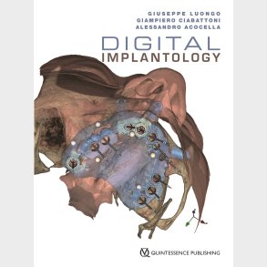Digital Implantology