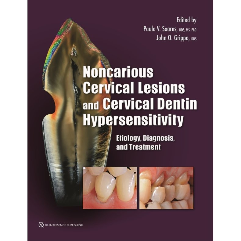 Noncarious Cervical Lesions and Cervical Dentin Hypersensitivity