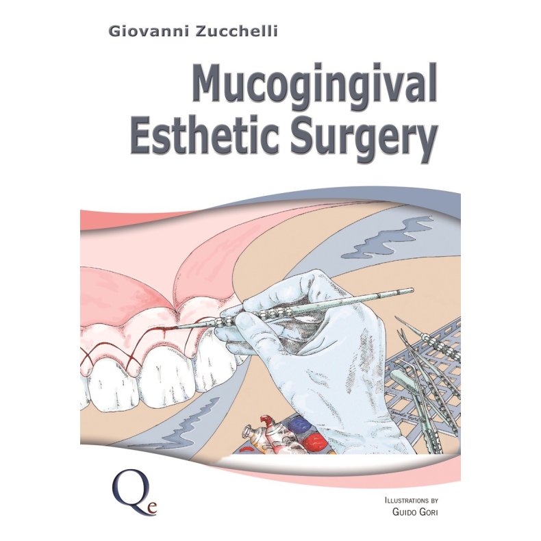 Mucogingival Esthetic Surgery