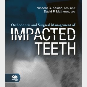 Orthodontic and Surgical Management of Impacted Teeth