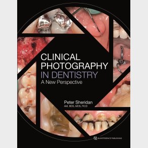 Clinical Photography in Dentistry