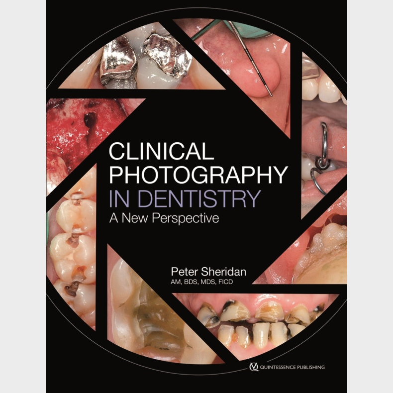 Clinical Photography in Dentistry