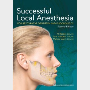 Successful Local Anesthesia