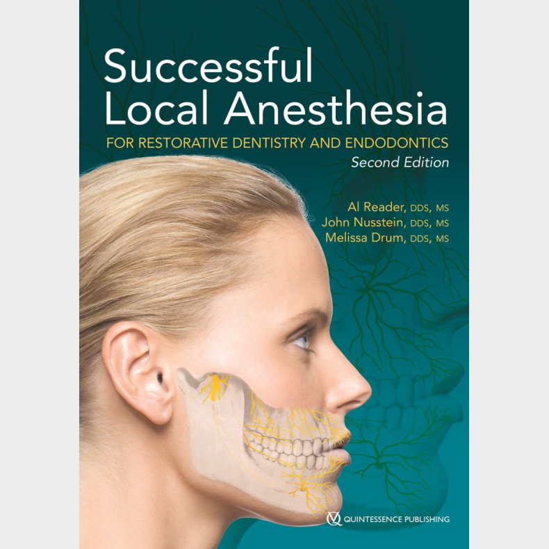 Successful Local Anesthesia