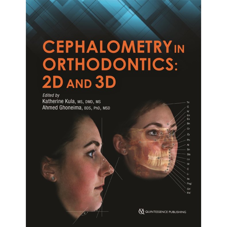 Cephalometry in Orthodontics