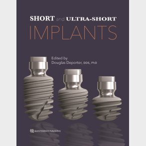 Short and Ultra-Short Implants