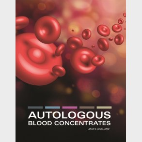 Autologous Blood Concentrates