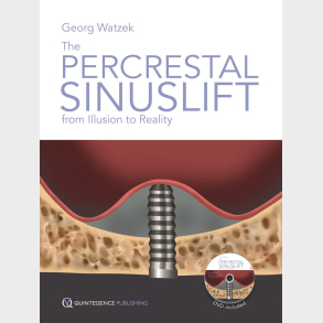 The Percrestal Sinuslift