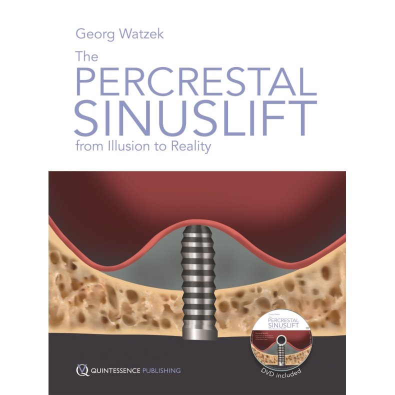 The Percrestal Sinuslift