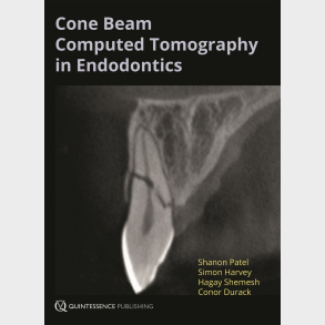 Cone Beam Computed Tomography in Endodontics