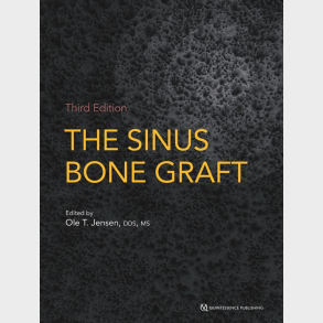 The Sinus Bone Graft