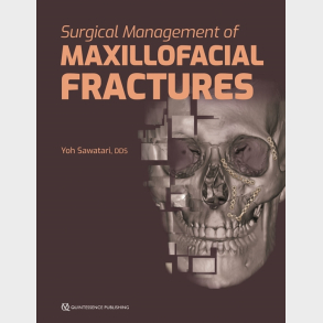 Surgical Management of Maxillofacial Fractures