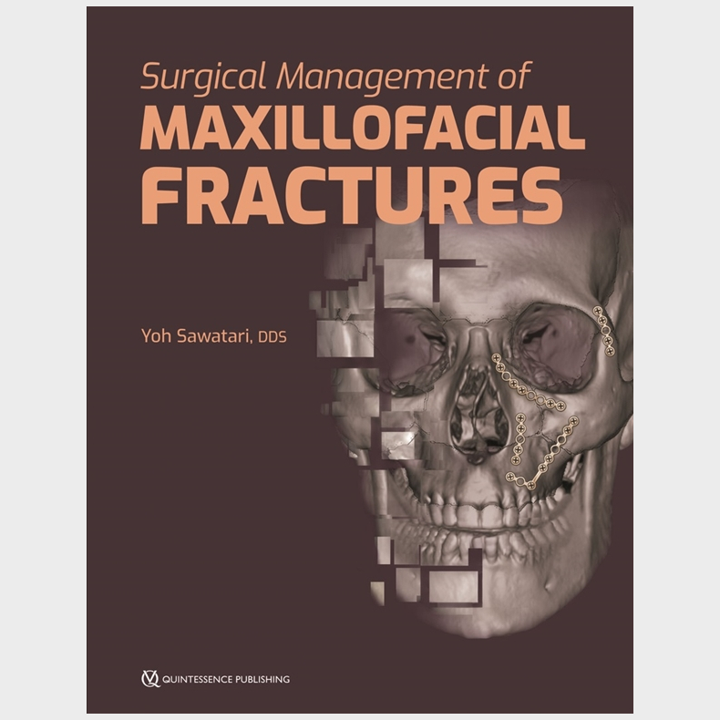 Surgical Management of Maxillofacial Fractures