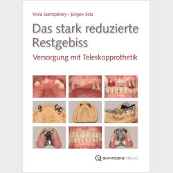 Das Stark Reduzierte Restgebiss