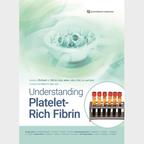 Understanding Platelet Rich Fibrin