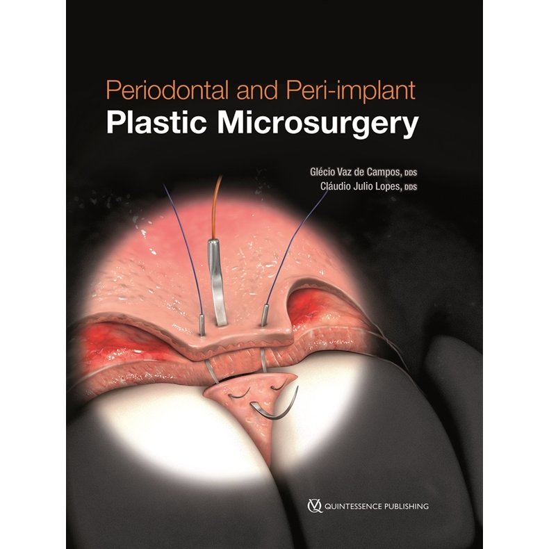 Periodontal and Peri-implant Plastic Microsurgery