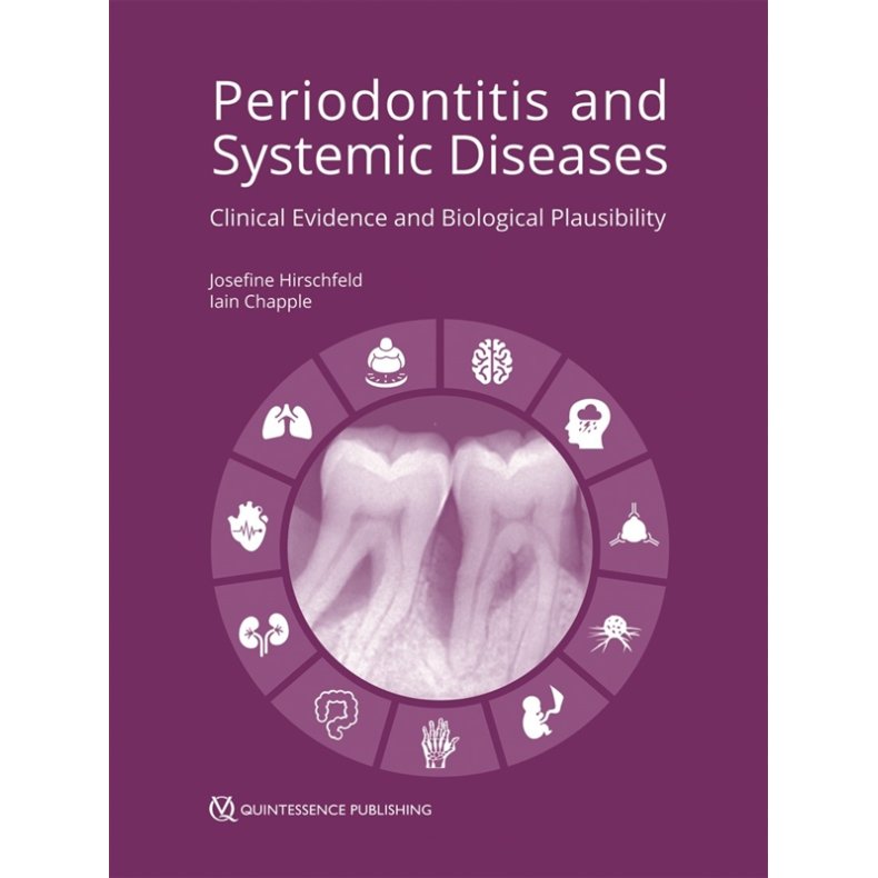 Periodontitis and Systemic Diseases - Clinical Evidence and Biological Plausibility