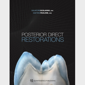 Posterior Direct Restorations