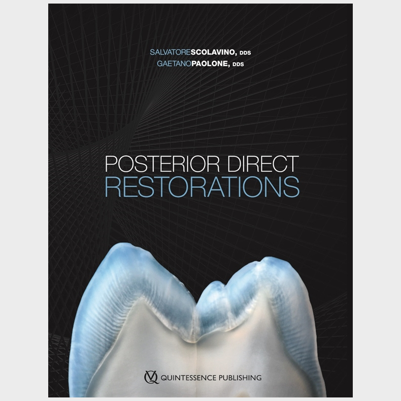 Posterior Direct Restorations