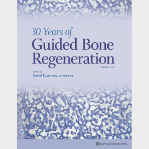 30 Years of Guided Bone Regeneration