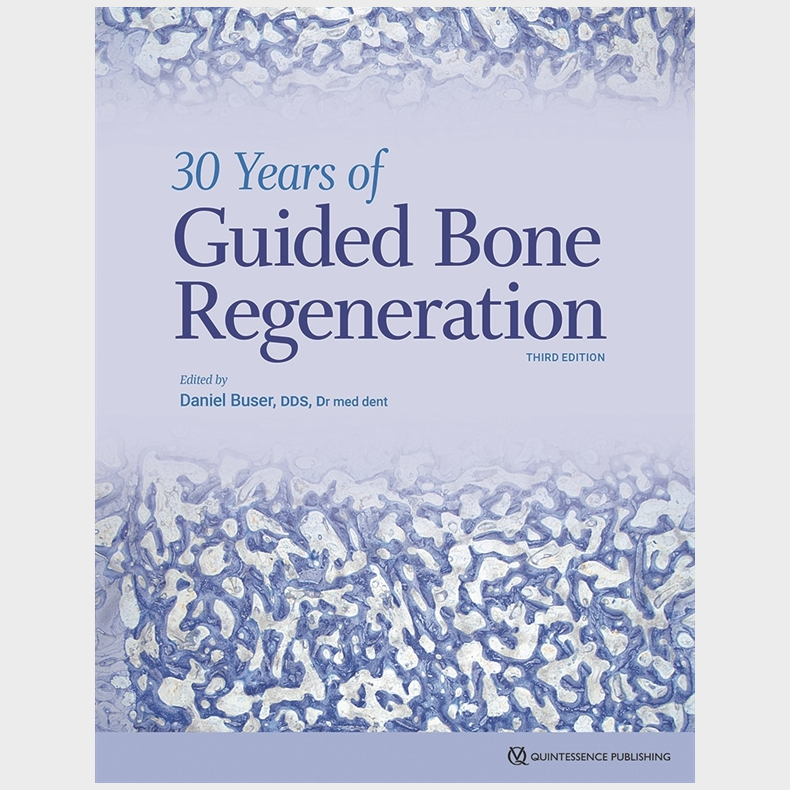 30 Years of Guided Bone Regeneration