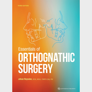 Essentials of Orthognathic Surgery