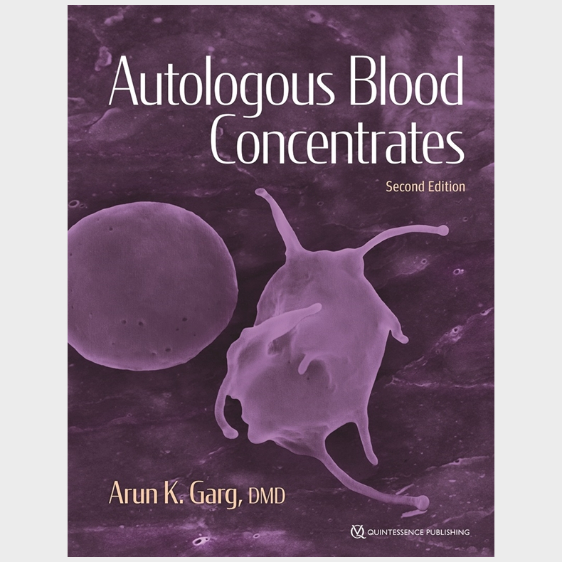 Autologous Blood Concentrates