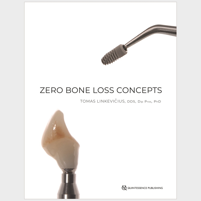 Zero Bone Loss Concepts