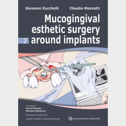 Mucogingival Esthetic Surgery around Implants