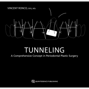 Tunneling - A Comprehensive Concept in Periodontal Plastic Surgery