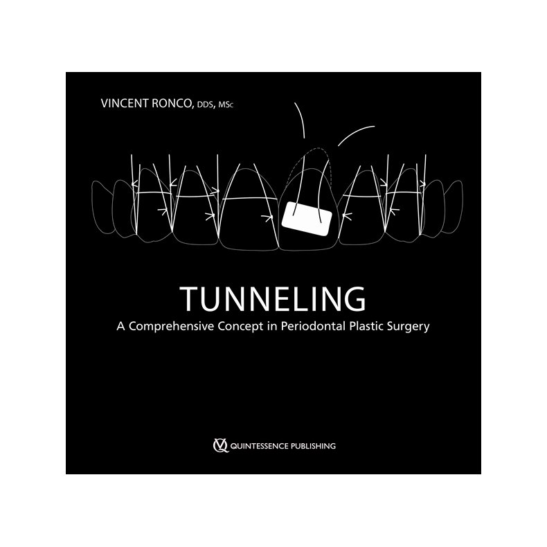 Tunneling - A Comprehensive Concept in Periodontal Plastic Surgery