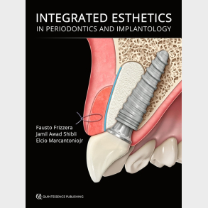 Integrated Esthetics in Periodontics and Implantology