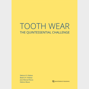 Tooth Wear