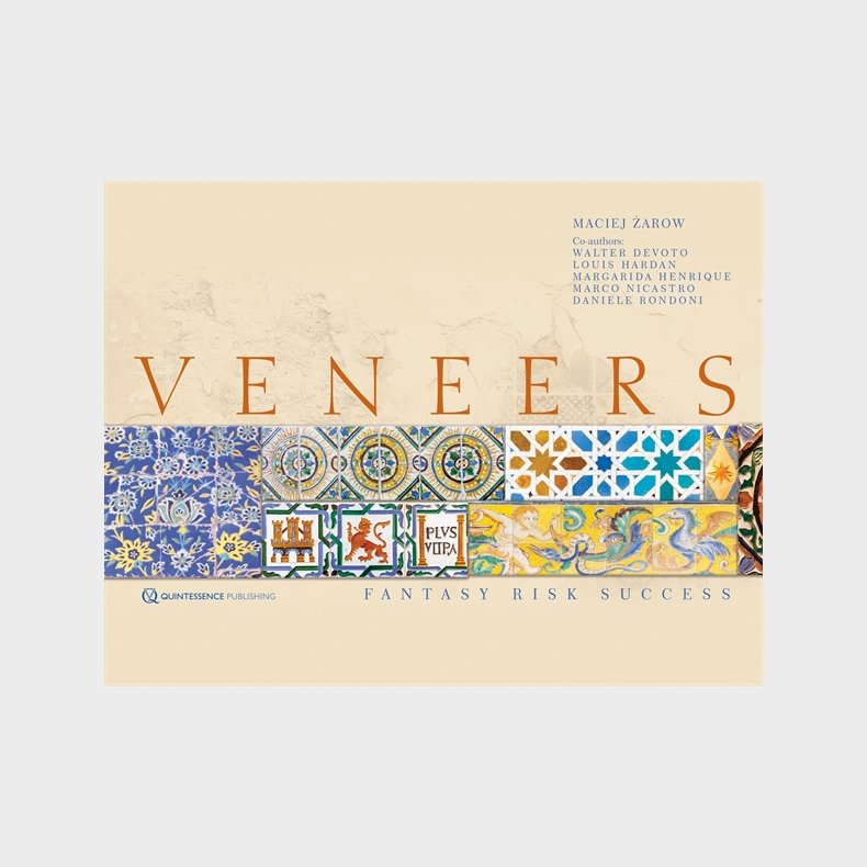 Veneers