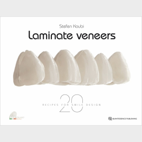 Laminate Veneers - 20 Recipes for Smile Design