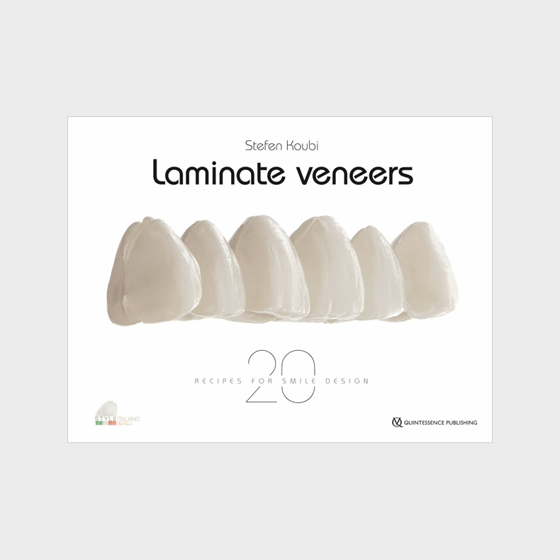Laminate Veneers - 20 Recipes for Smile Design