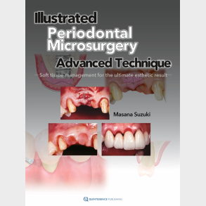 Illustrated Advanced Technique of Periodontal Microsurgery