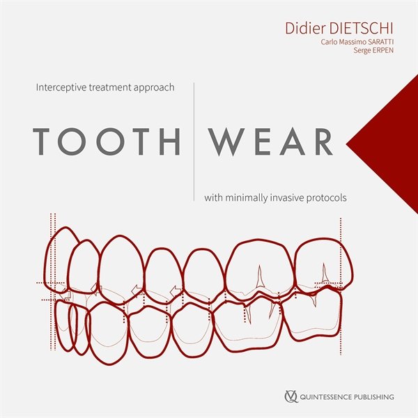 Tooth Wear Bøger Dentalinstituttet