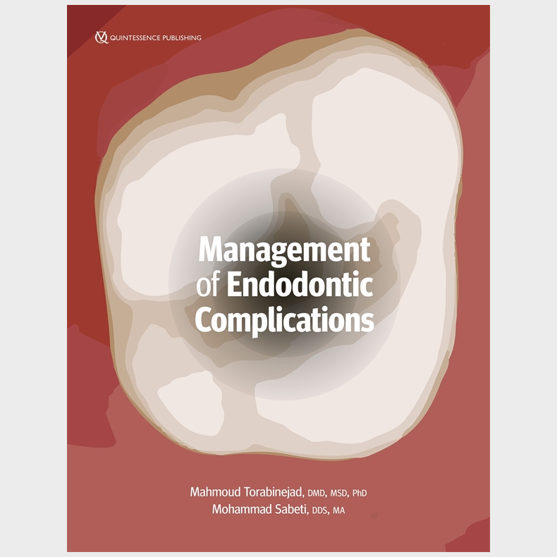 Management of Endodontic Complications
