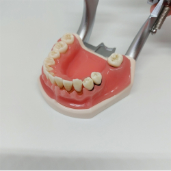 Parodontitis Studiemodel med Aftageligt Gingiva 