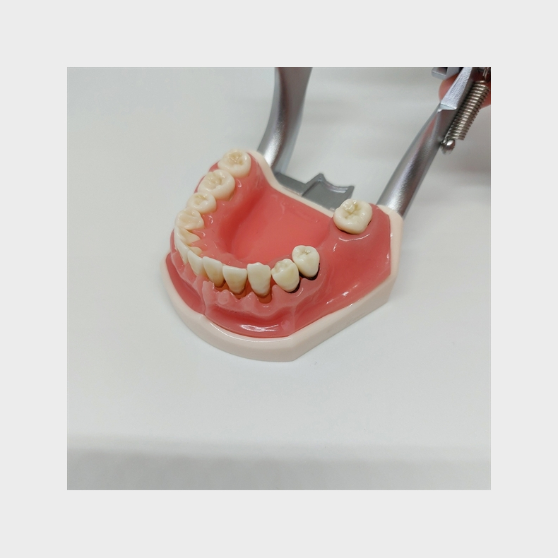 Parodontitis Studiemodel med Aftageligt Gingiva 