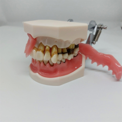 Parodontitis Studiemodel med Aftageligt Gingiva 