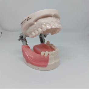 Implantologi standard trningsmodel 