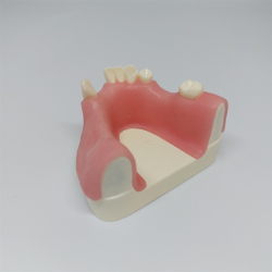 Knogleopbygning - trningsmodel 