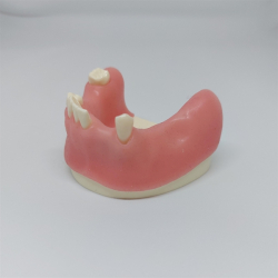 Knogleopbygning - trningsmodel 