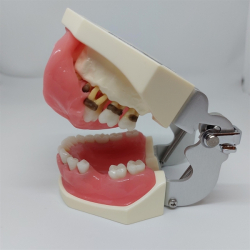 Periodontisk trningsmodel